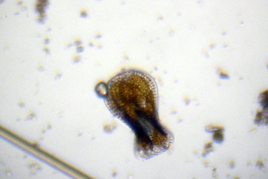 Diatomea: Surirella spiralis